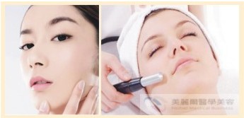 除皺拉皮電磁波拉皮